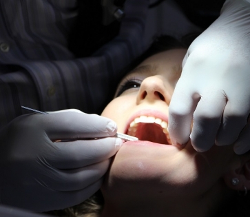 Blog mejores dentistas implantes dentales valencia 363x315 Blog